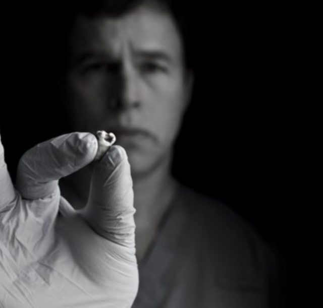Imagen: El dentista Michael Zuk con la muela de John Lennon, 18 de octubre de 2019 (Imagen: Especial)