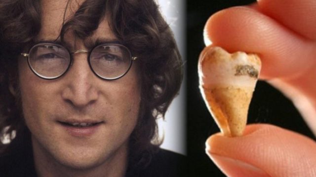 Imagen: Diente con caries del músico John Lennon, 21 de octubre de 2019 (Imagen: Especial)