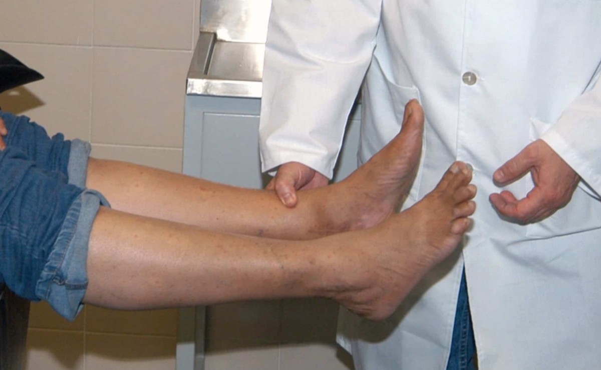 Científicos del IPN crean parche contra pie diabético; costará 2 mil pesos