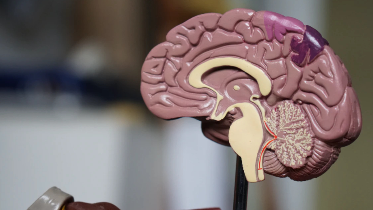 cerebro, sesgo cognitivo