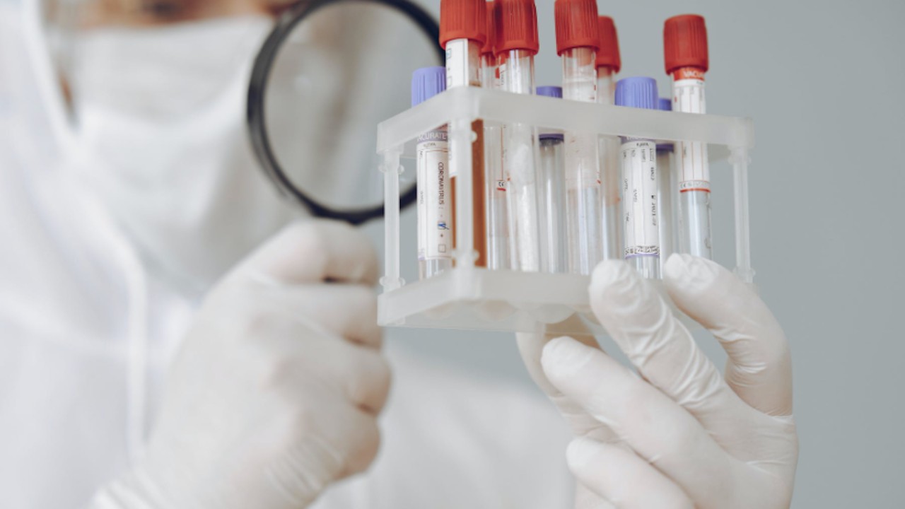 Venden pruebas negativas de Covid-19 para ir a otros países hasta en 7 mil pesos