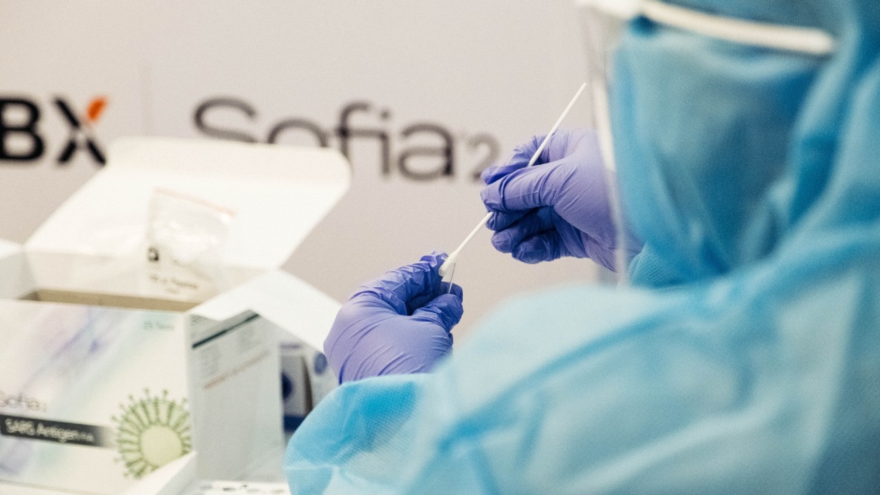 Este es el precio de las pruebas COVID PCR y antígenos según Profeco